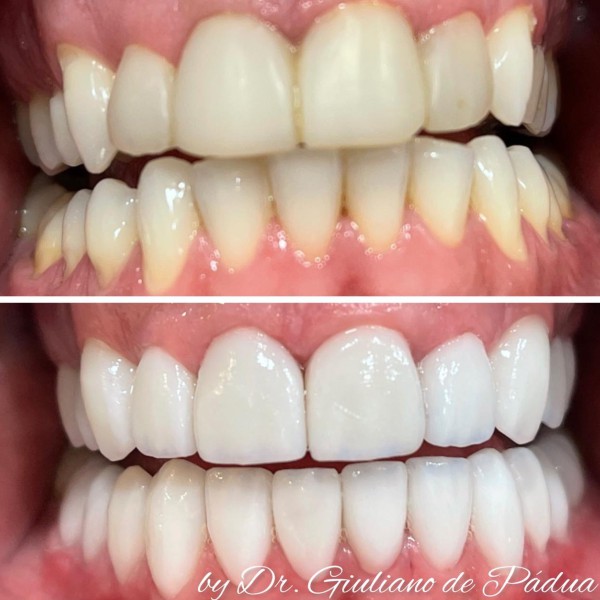 Estética — Dr. Giuliano de Pádua