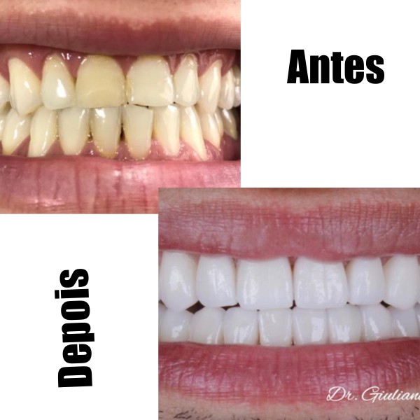 Reabilitação Oral — Dr. Giuliano de Pádua