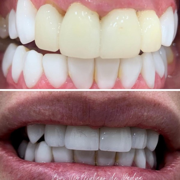 Reabilitação Oral — Dr. Giuliano de Pádua
